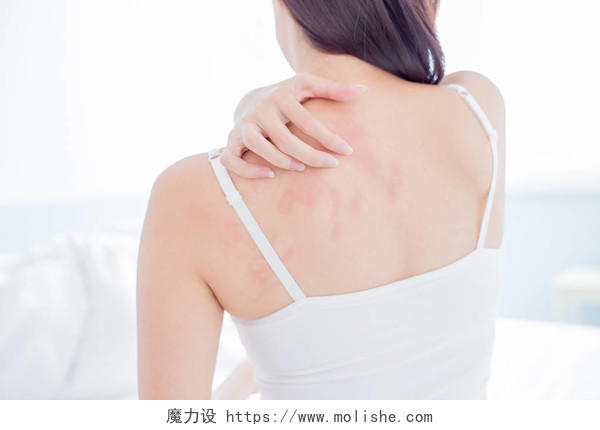 抓伤肩膀和脖子皮肤干燥皮肤过敏肩颈疼痛